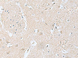 Immunohistochemistry of paraffin-embedded Human brain tissue using TPD52L3 Polyclonal Antibody at dilution of 1:160(×200)
