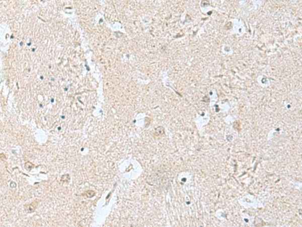 Anti-Human TPD52L3 Antibody