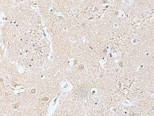 Anti-Human TPD52L3 Antibody