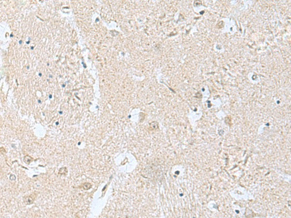 Immunohistochemistry of paraffin-embedded Human brain tissue using TPD52L3 Polyclonal Antibody at dilution of 1:160(×200)