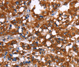 Anti-Human GAGE12I Antibody - ABMIUM