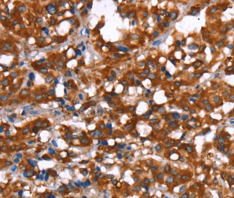 Anti-Human GAGE12I Antibody - ABMIUM