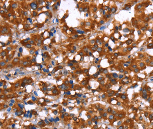 Anti-Human GAGE12I Antibody - ABMIUM