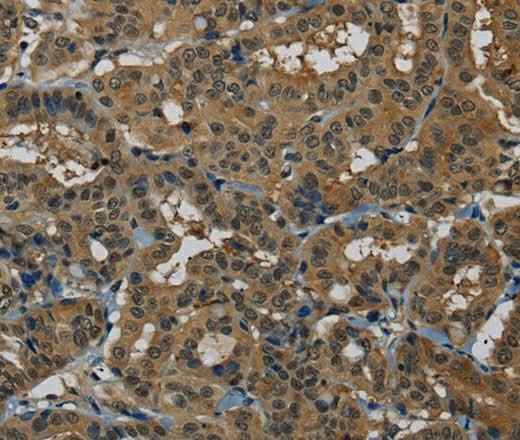 Anti-Human/Mouse PNN Antibody