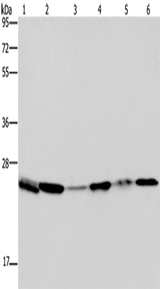 Anti-Human/Mouse/Rat ARHGDIA Antibody - ABMIUM