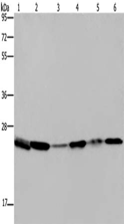 Anti-Human/Mouse/Rat ARHGDIA Antibody - ABMIUM