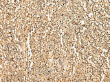 Immunohistochemistry of paraffin-embedded Human tonsil tissue using PPM1G Polyclonal Antibody at dilution of 1:35(×200)