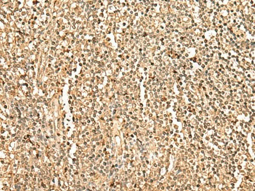 Immunohistochemistry of paraffin-embedded Human tonsil tissue using PPM1G Polyclonal Antibody at dilution of 1:35(×200)