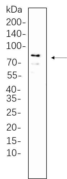 Anti-Human/Mouse/Rat DDX4 Antibody [B1060] - ABMIUM