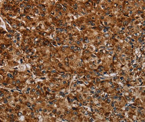 Anti-Human/Mouse NDUFAB1 Antibody - ABMIUM