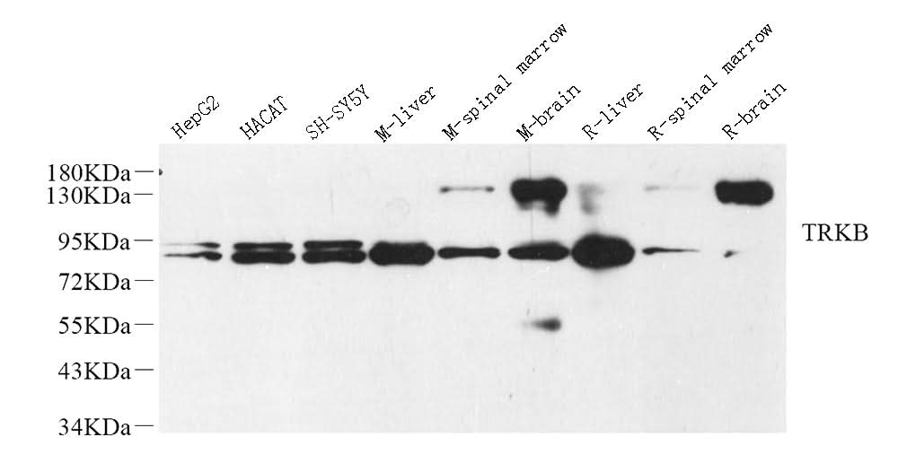 Western Blot analysis of various samples using NTRK2 Polyclonal Antibody at dilution of 1:1000.