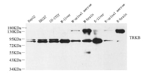Western Blot analysis of various samples using NTRK2 Polyclonal Antibody at dilution of 1:1000.