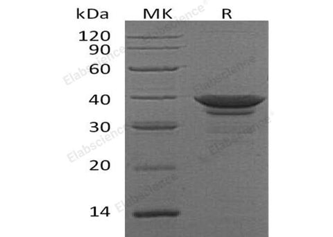 Recombinant Human Arginase-1/ARG1 Protein (E.coli, His Tag) - ABMIUM