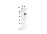 SDS-PAGE analysis of Human SCF/c-kit Ligand proteins , 2 μg/lane of Recombinant Human SCF/c-kit Ligand proteins was resolved with SDS-PAGE under reducing conditions , showing bands at 50 kDa.