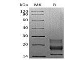 Recombinant Mouse Interferon γ/IFNG Protein (His Tag) - ABMIUM