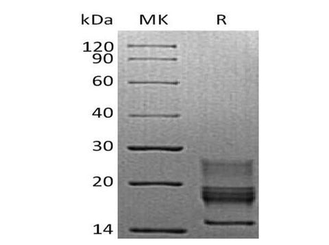 Recombinant Mouse Interferon γ/IFNG Protein (His Tag) - ABMIUM