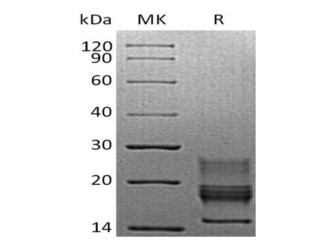 Recombinant Mouse Interferon γ/IFNG Protein (His Tag) - ABMIUM