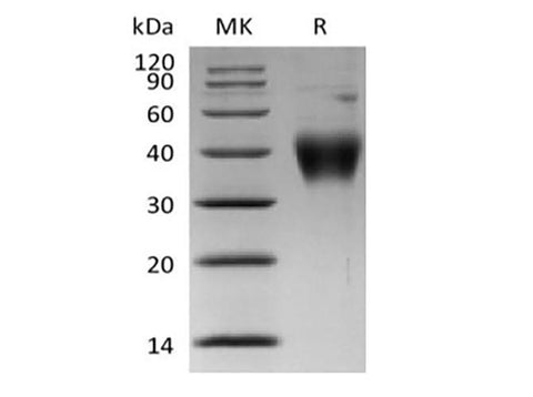 Recombinant Human Thymic Stromal Lymphopoietin Receptor/TSP R/CRLF2 (His Tag) - ABMIUM
