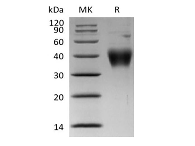 Recombinant Human Thymic Stromal Lymphopoietin Receptor/TSP R/CRLF2 (His Tag) - ABMIUM