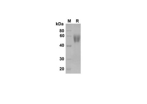 SDS-PAGE analysis of Rat L-Selectin/CD62L proteins , 2 μg/lane of Recombinant Rat L-Selectin/CD62L proteins was resolved with SDS-PAGE under reducing conditions , showing bands at 55-60 kDa.