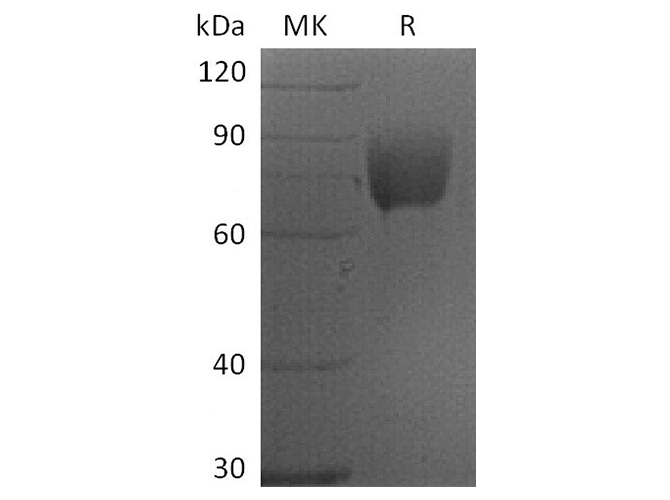 Recombinant Human CD80/B7-1 Protein (mFc Tag) - ABMIUM