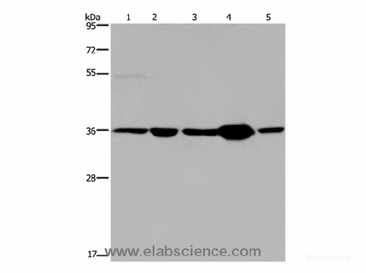 Anti-Human/Mouse/Rat LZTFL1 Antibody - ABMIUM