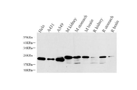 Western Blot analysis of various samples using NTS Polyclonal Antibody at dilution of 1:1000.