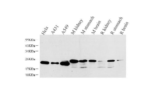 Western Blot analysis of various samples using NTS Polyclonal Antibody at dilution of 1:1000.
