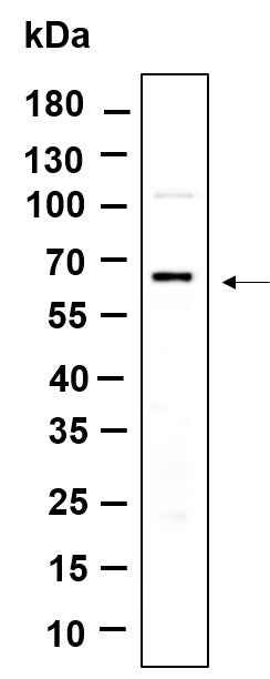 Anti-Human/Mouse/Rat PINK1 Antibody [B1153] - ABMIUM