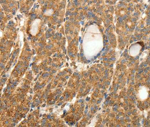 Anti-Human/Mouse/Rat SYT11 Antibody