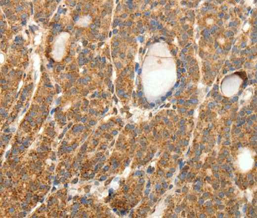 Anti-Human/Mouse/Rat SYT11 Antibody