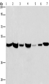 Anti-Human APMAP Antibody - ABMIUM