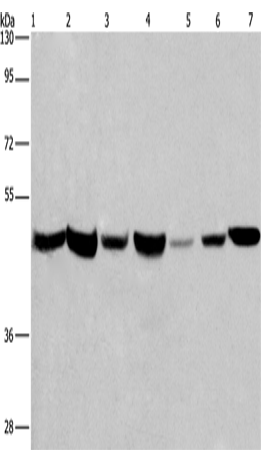 Anti-Human APMAP Antibody - ABMIUM