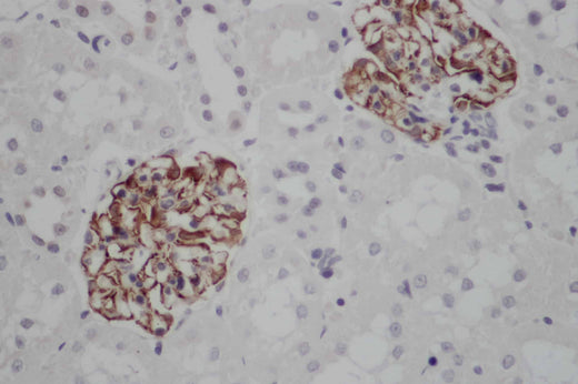 Anti-Human NES Antibody - ABMIUM