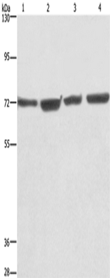 Anti-Human/Mouse KLF11 Antibody - ABMIUM