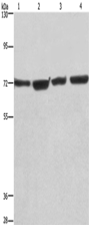 Anti-Human/Mouse KLF11 Antibody - ABMIUM