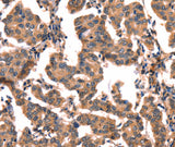 Anti-Human CGA Antibody - ABMIUM