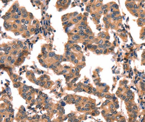 Anti-Human CGA Antibody - ABMIUM