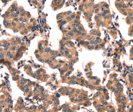 Anti-Human CGA Antibody - ABMIUM
