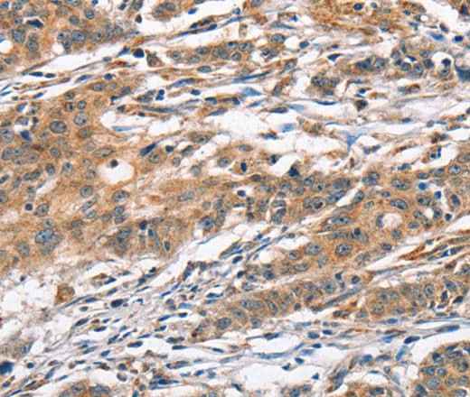 Anti-Human/Mouse/Rat CAMK4 Antibody
