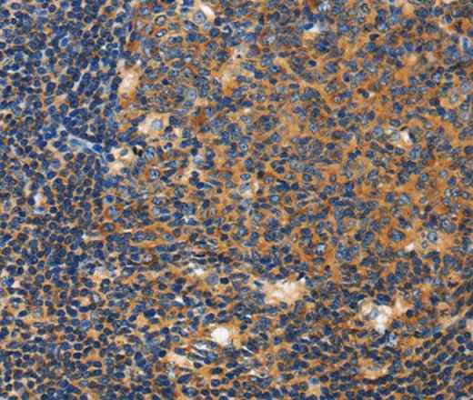 Anti-Human/Mouse CERK Antibody