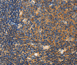 Anti-Human/Mouse CERK Antibody - ABMIUM