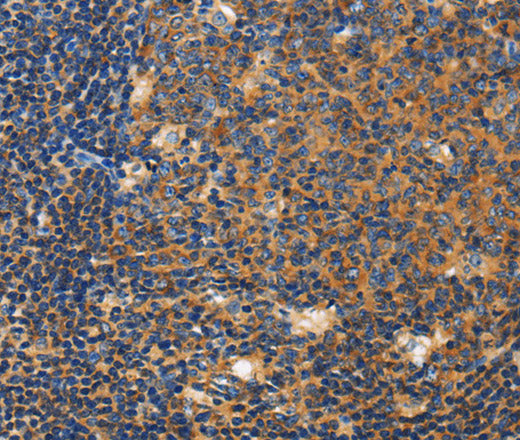 Anti-Human/Mouse CERK Antibody - ABMIUM