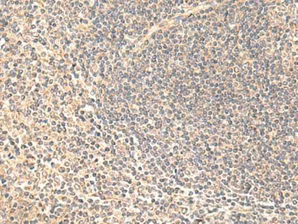 Anti-Human/Mouse/Rat SULT4A1 Antibody