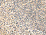 Immunohistochemistry of paraffin-embedded Human tonsil tissue using SULT4A1 Polyclonal Antibody at dilution of 1:65(×200)