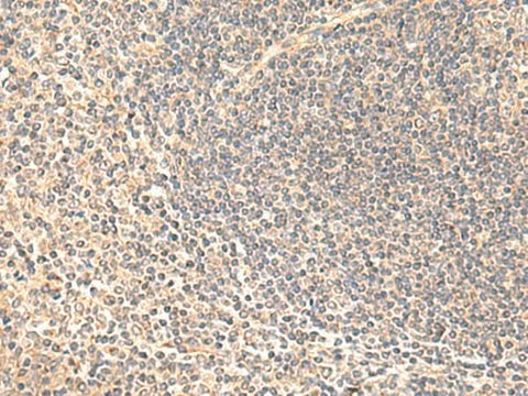 Immunohistochemistry of paraffin-embedded Human tonsil tissue using SULT4A1 Polyclonal Antibody at dilution of 1:65(×200)