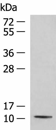 Western blot analysis of Mouse kidney tissue lysate using PCBD1 Polyclonal Antibody at dilution of 1:800