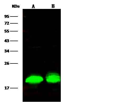 Anti-Human EIF4EBP1 Antibody [A1158] - ABMIUM