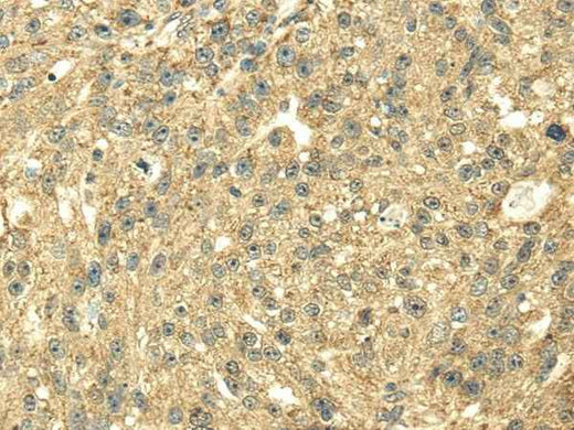 Anti-Human/Mouse/Rat SDHA Antibody