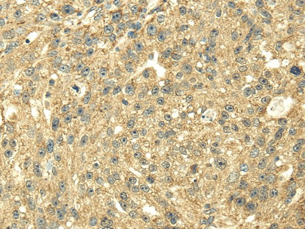 Anti-Human/Mouse/Rat SDHA Antibody - ABMIUM